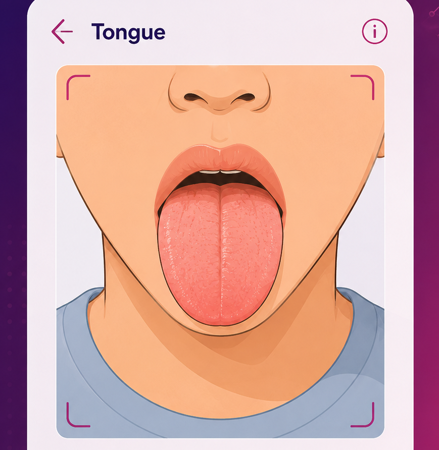 Tongue Guide